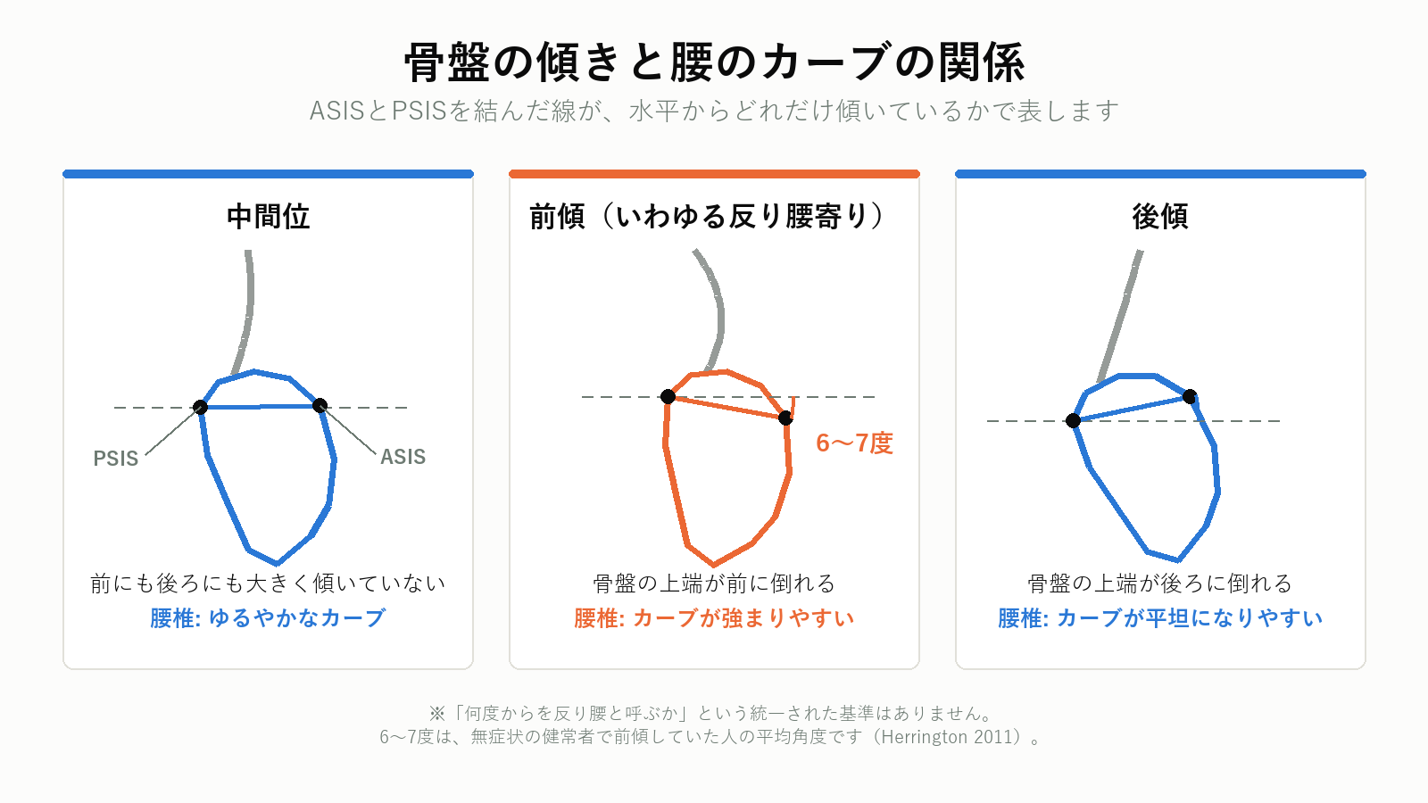 骨盤の前傾・中間位・後傾の違いを示した図