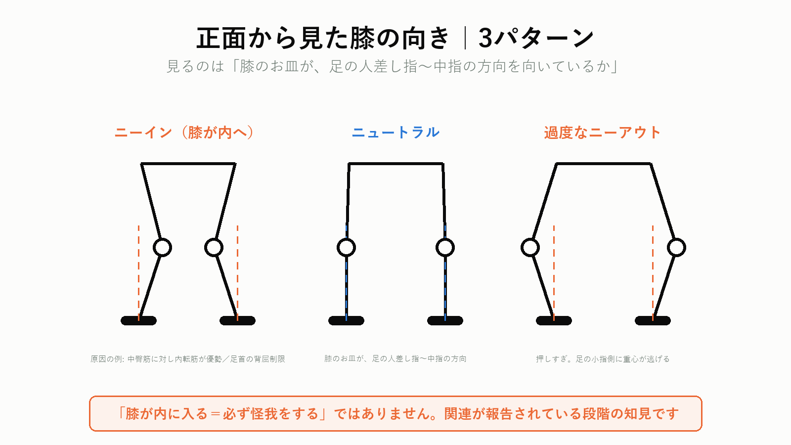 スクワットの膝の向き(ニーイン・ニュートラル・ニーアウト)3パターン比較図